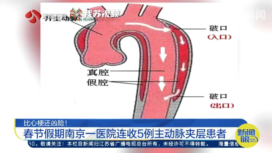 建议春节假期取消调休,2025管家婆一句话001期,精准解释落实及其象征意义_破例版V5.1